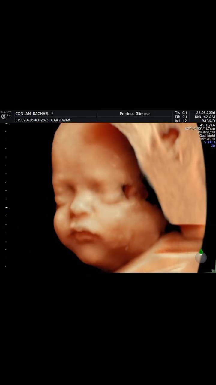 Post 2 by Precious Glimpse ™️ on Instagram (video)