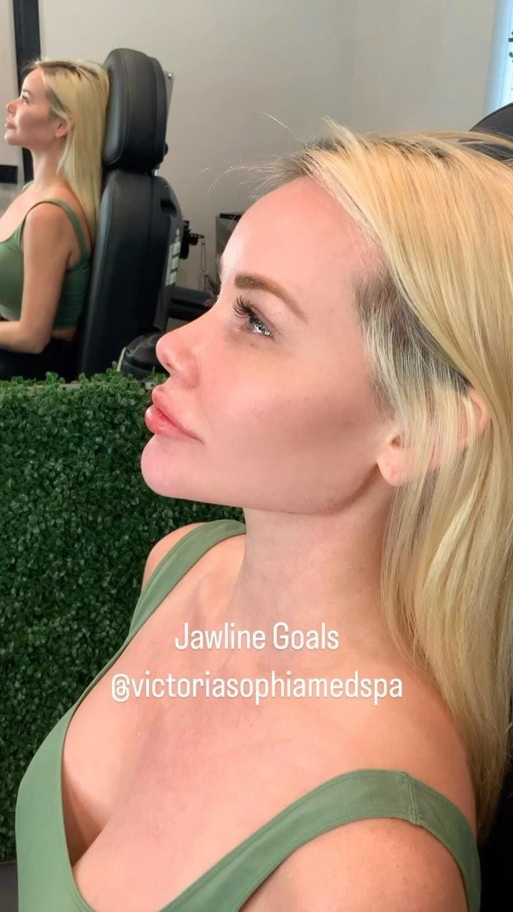 Post 10 by VS Med Spas on Instagram (video)