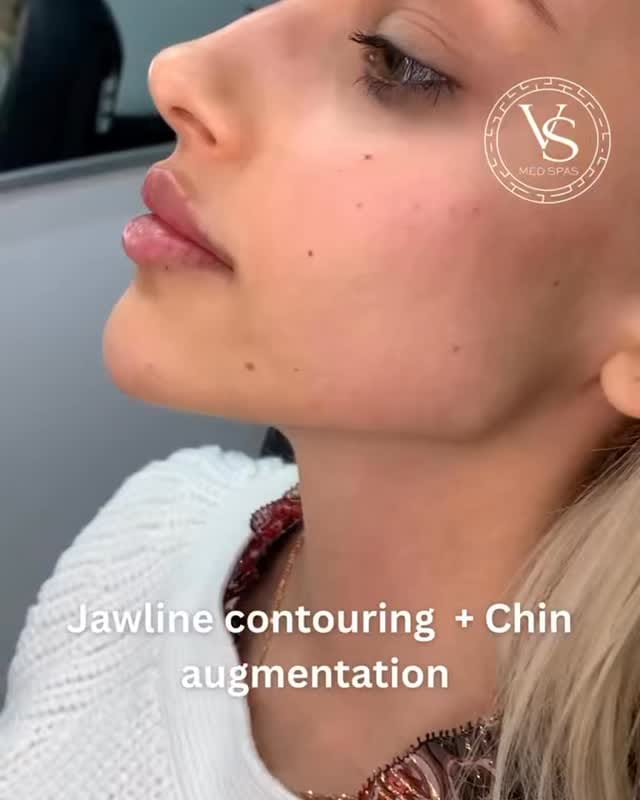 Post 7 by VS Med Spas on Instagram (video)