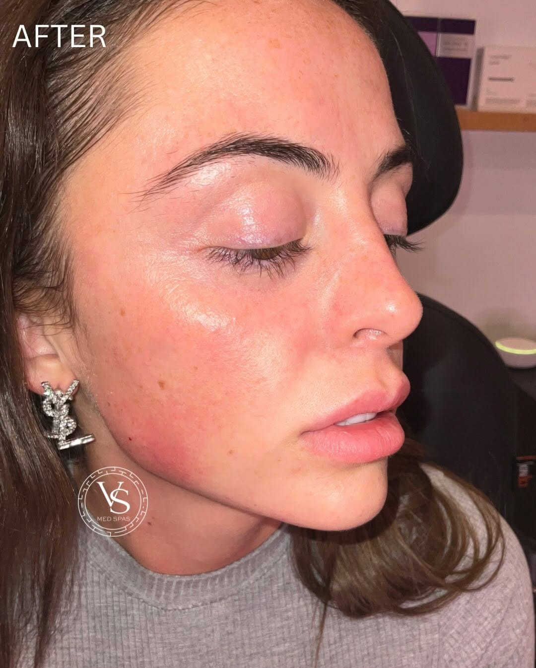 Post 5 by VS Med Spas on Instagram (carousel)