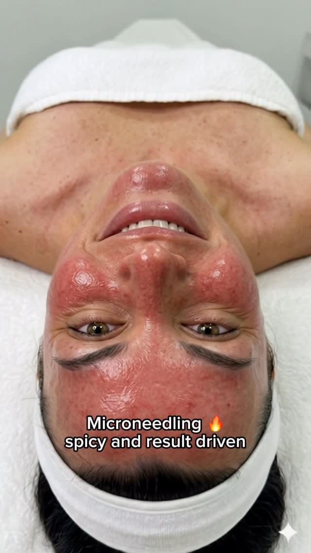 Post 9 by Ashley Mazin | Denver/Parker Esthetician on Instagram (video)
