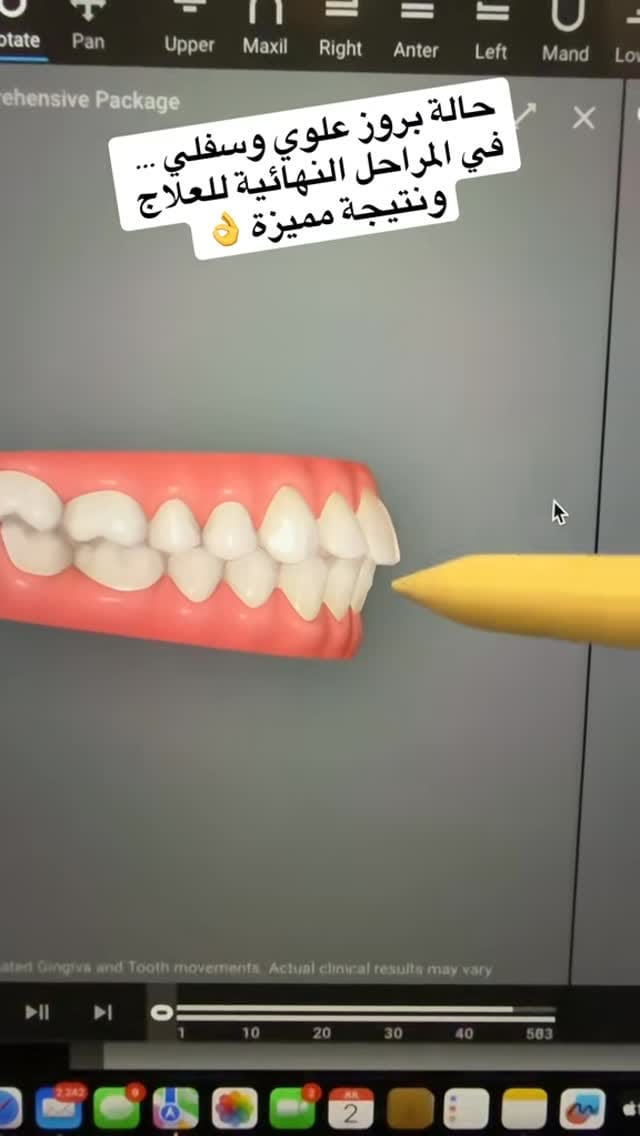 Post 9 by Dr.Mohammed albwardi د.محمد البواردي on Instagram (video)