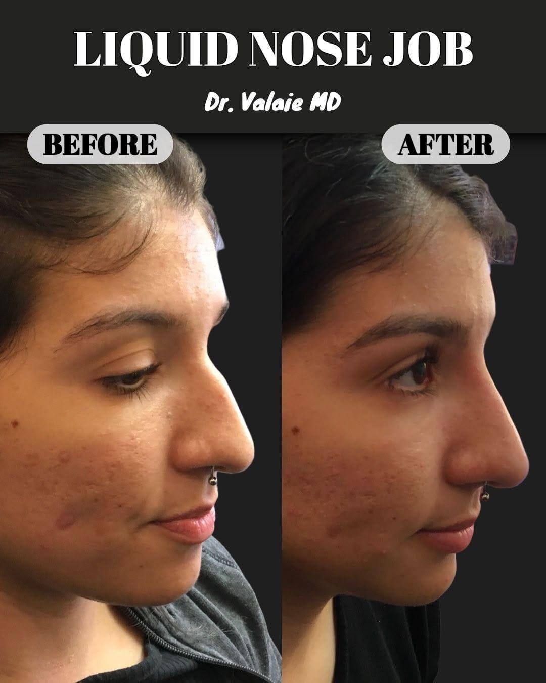 Post 2 by Dr. Faraz Valaie, MD on Instagram (image)
