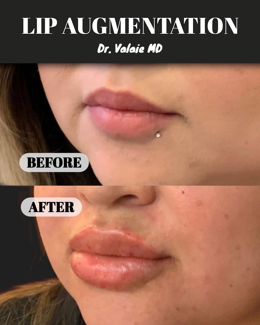 Post 10 by Dr. Faraz Valaie, MD on Instagram (image)