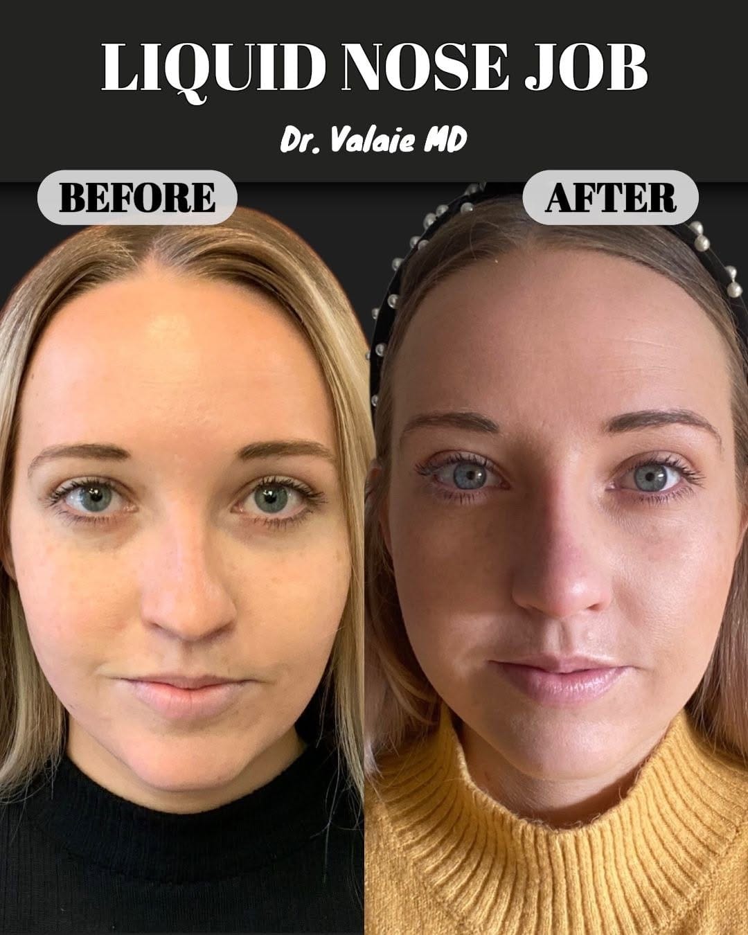 Post 4 by Dr. Faraz Valaie, MD on Instagram (image)