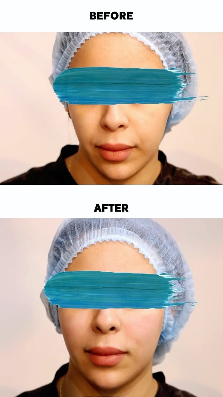 Post 8 by DR Rania Alsarrari on Instagram (video)
