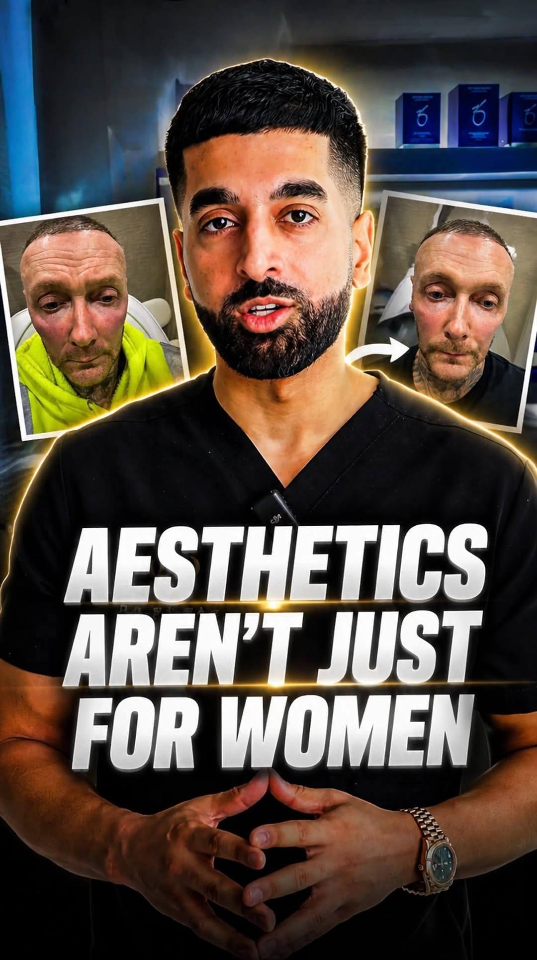 Post 4 by Dr Nawaz - Cosmetic Doctor - London Dubai Sheffield Leicester on Instagram (video)