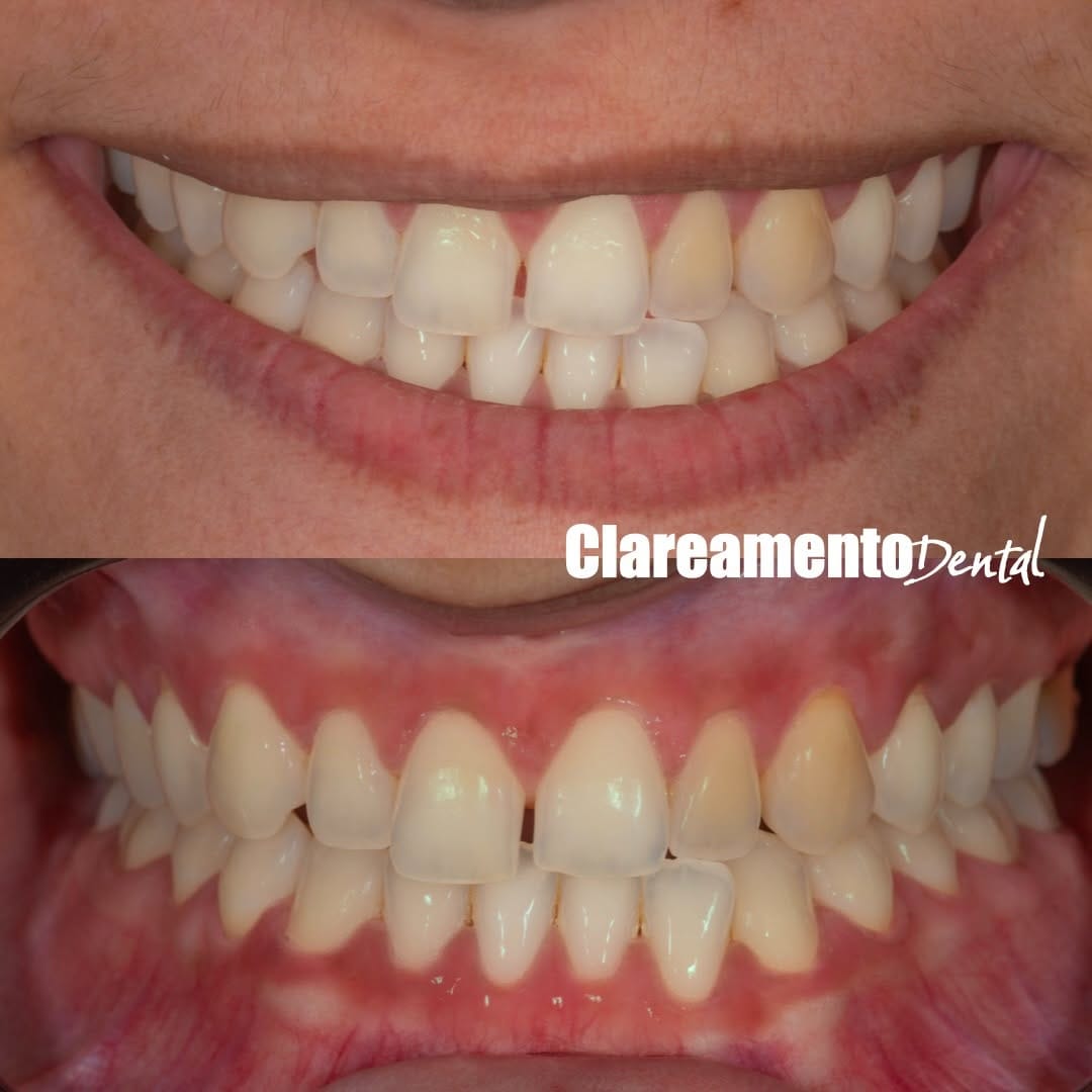 Post 4 by Crisnicaw Verissimo / Dentista / Professor on Instagram (carousel)