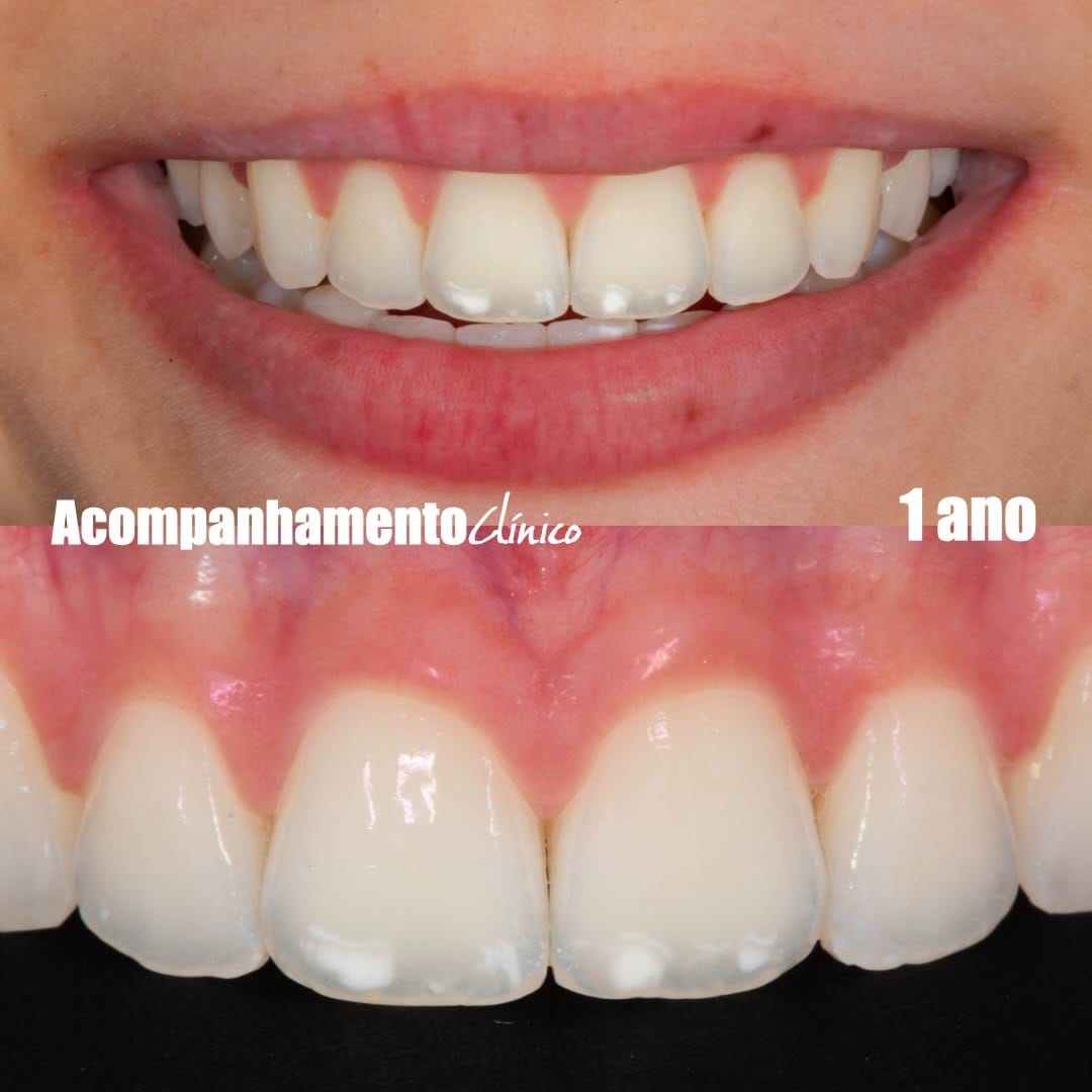 Post 3 by Crisnicaw Verissimo / Dentista / Professor on Instagram (carousel)