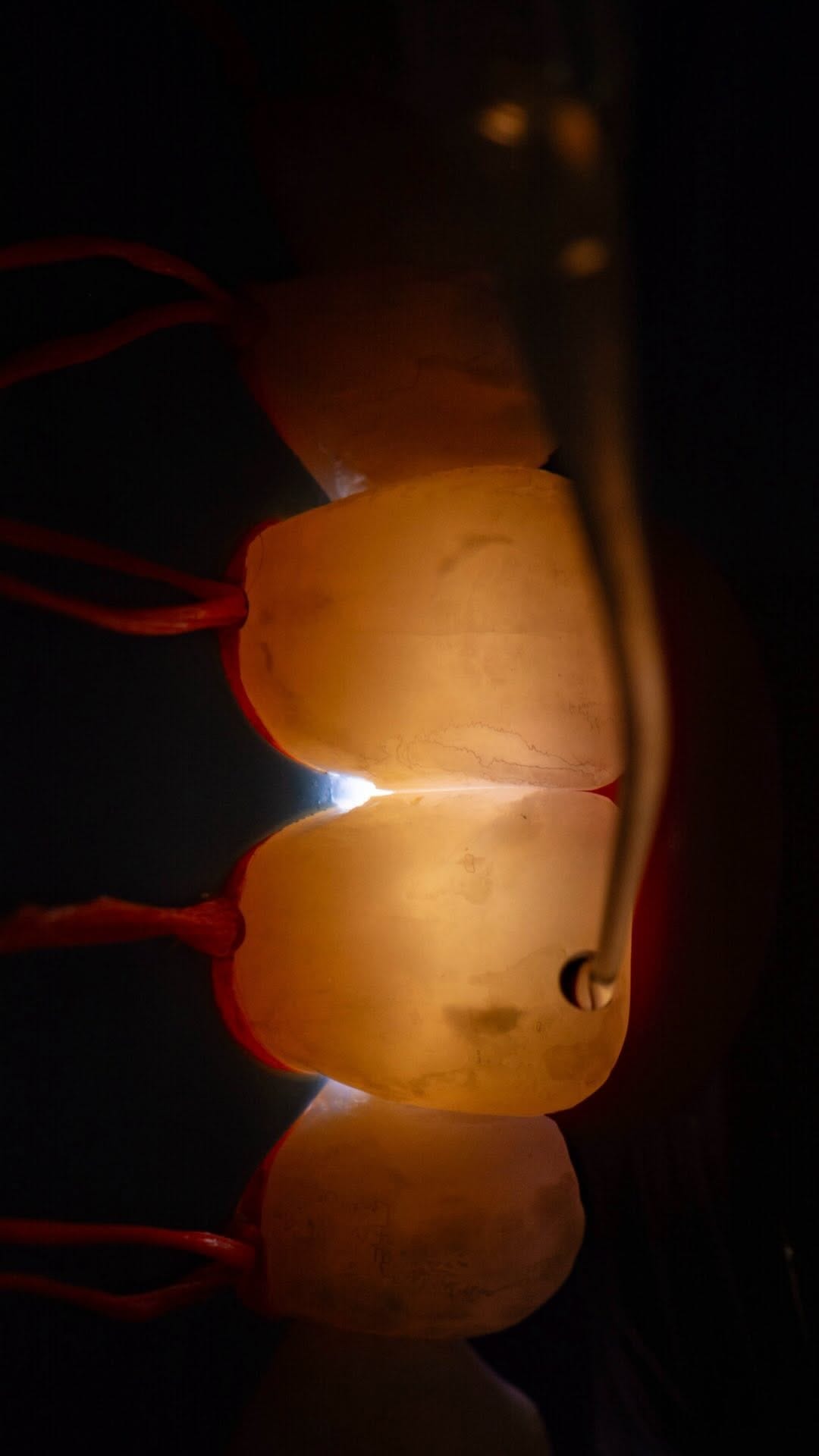 Post 2 by Crisnicaw Verissimo / Dentista / Professor on Instagram (video)