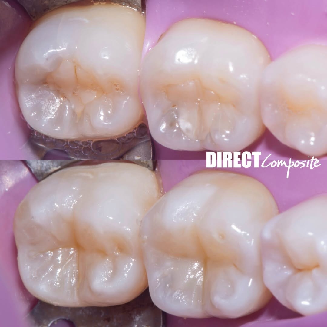 Post 5 by Crisnicaw Verissimo / Dentista / Professor on Instagram (image)