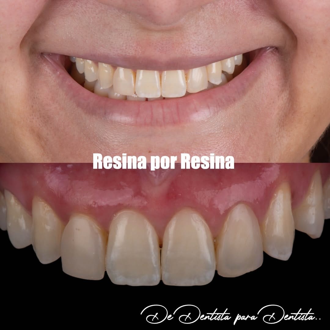 Post 6 by Crisnicaw Verissimo / Dentista / Professor on Instagram (carousel)