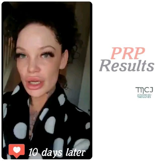 Post 2 by Jonathan Mendoza on Instagram (video)