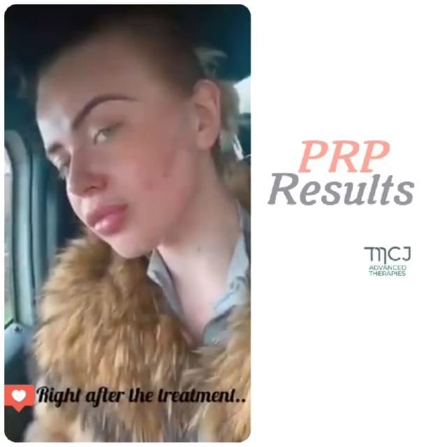 Post 8 by Jonathan Mendoza on Instagram (video)
