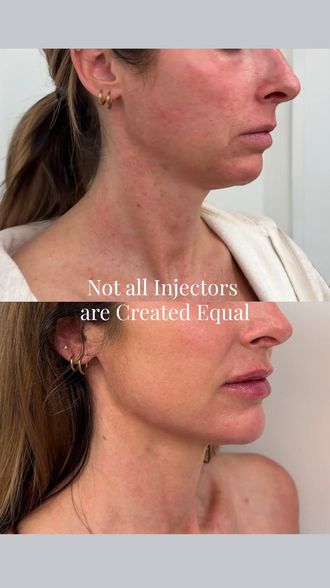 Post 5 by Jillian Brooke Utah Injector on Instagram (video)