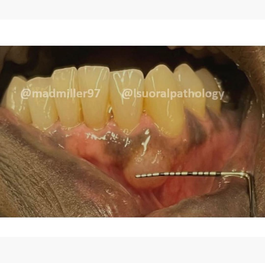 Post 10 by Drs. K Cordell & M Rosebush on Instagram (carousel)