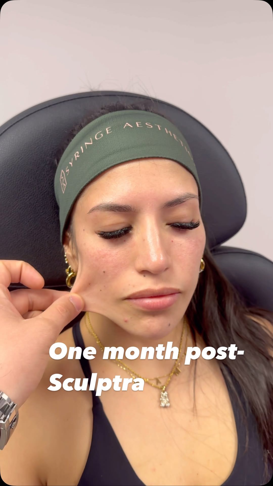 Post 9 by Manuel Guillen Robles - Nurse Practitioner Injector on Instagram (video)