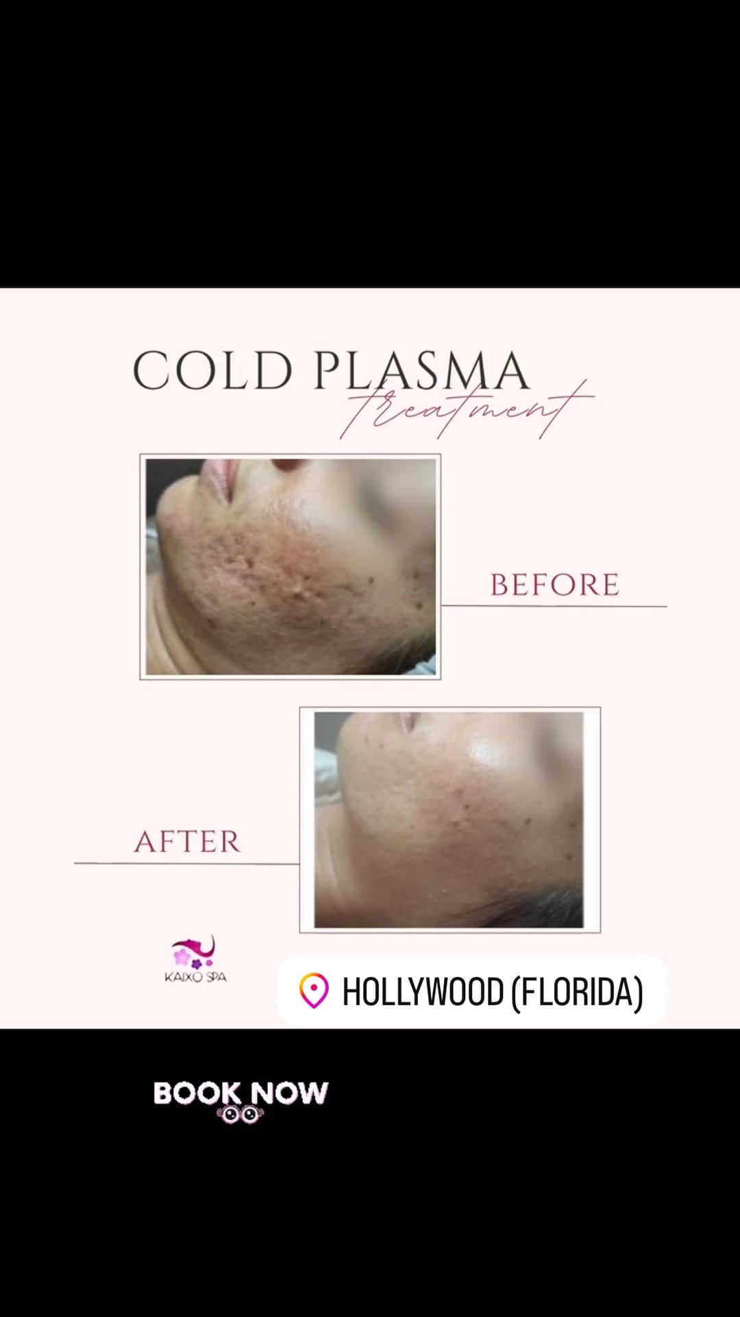 Post 8 by KAIXO SPA on Instagram (video)