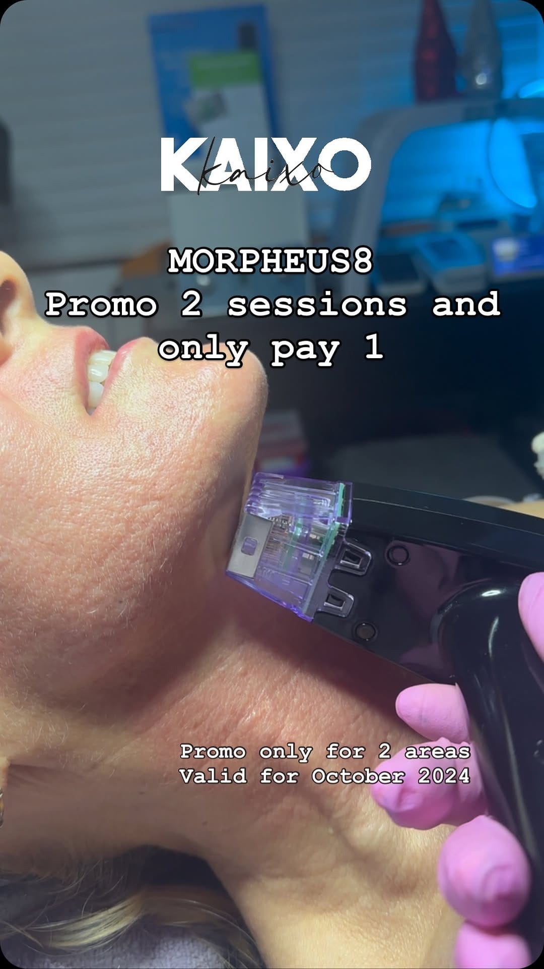 Post 9 by KAIXO SPA on Instagram (video)
