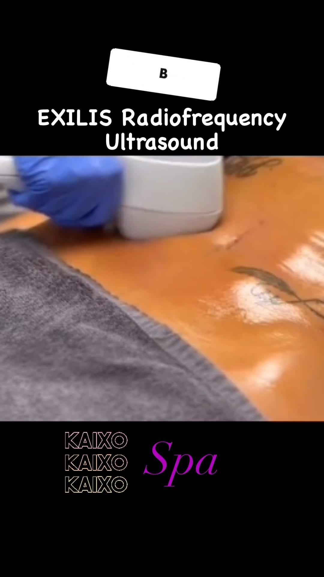 Post 10 by KAIXO SPA on Instagram (video)