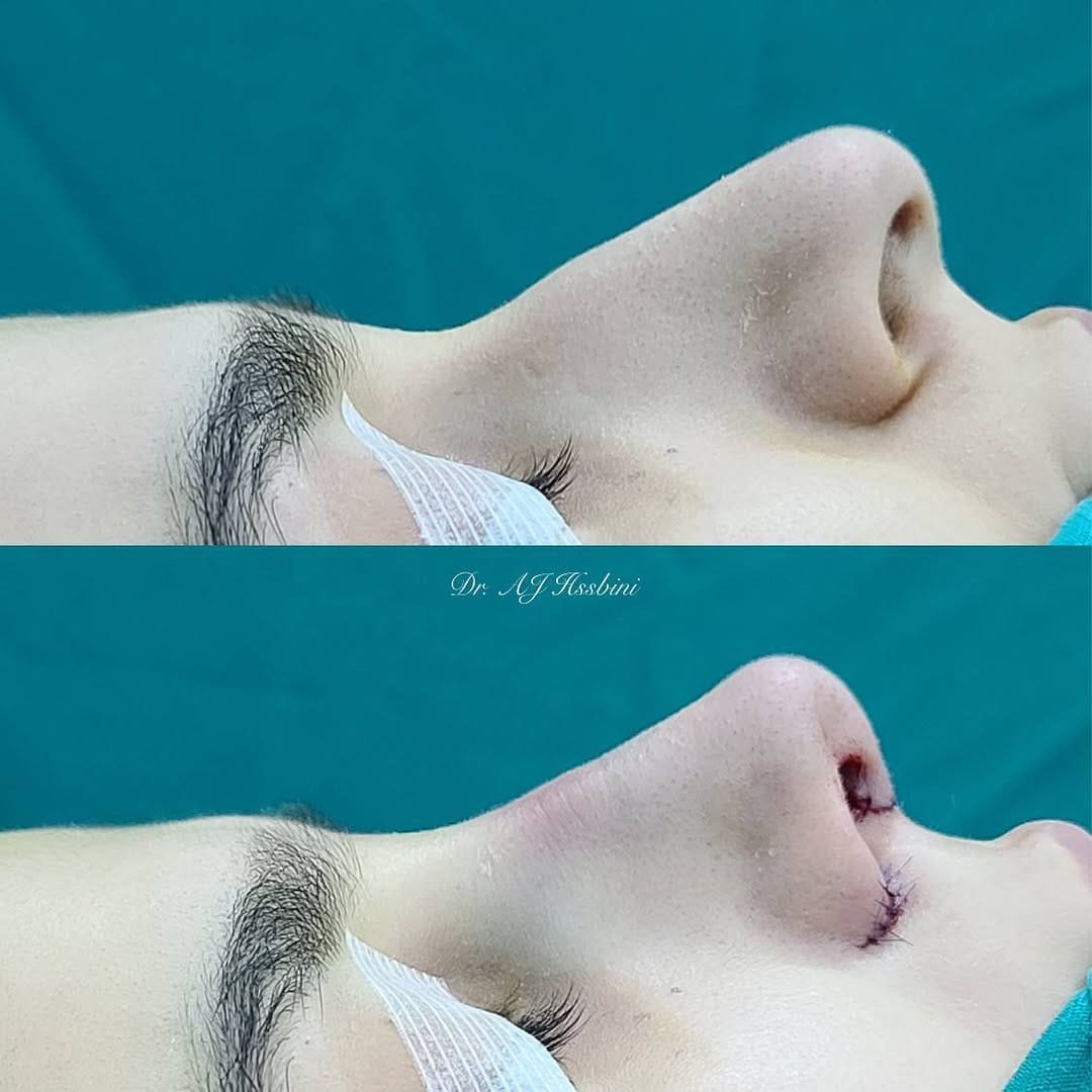 Post 9 by Dr. AJ Hasbini on Instagram (video)