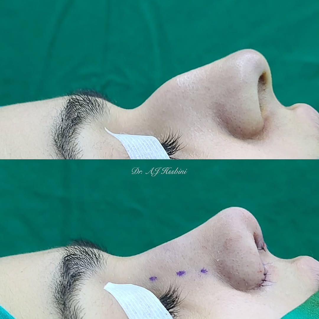 Post 4 by Dr. AJ Hasbini on Instagram (image)