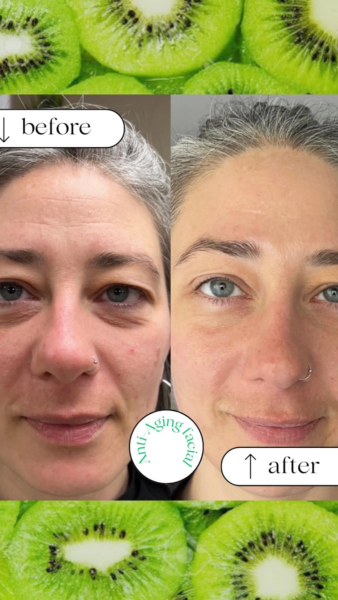 Post 10 by Skincare & Facials | Vegan Day Spa on Instagram (video)