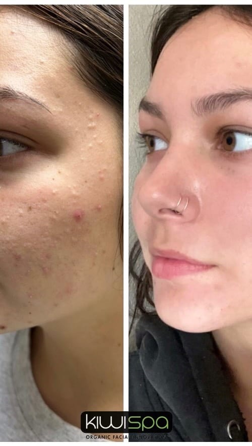 Post 3 by Skincare & Facials | Vegan Day Spa on Instagram (video)