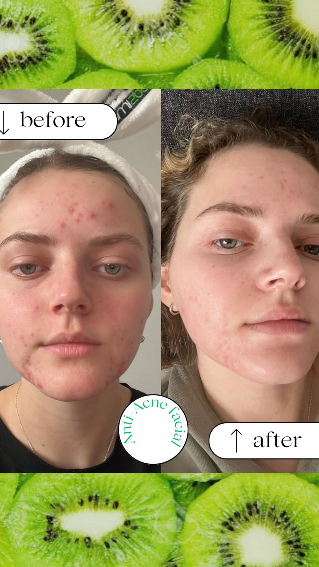 Post 8 by Skincare & Facials | Vegan Day Spa on Instagram (video)