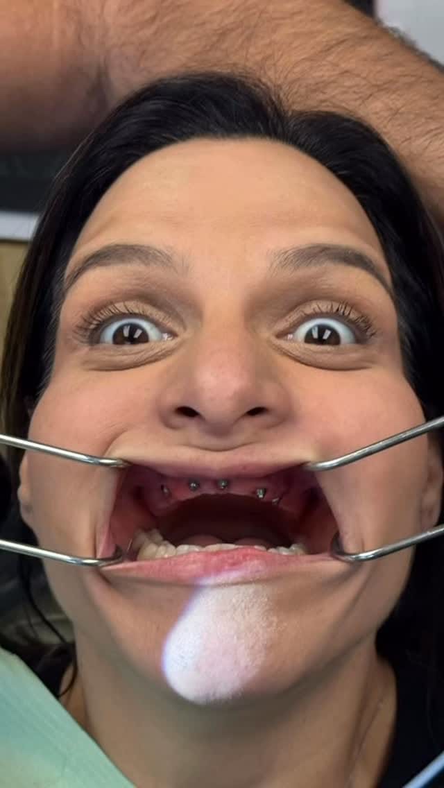 Post 9 by Dr. Gustavo De Oliveira on Instagram (video)