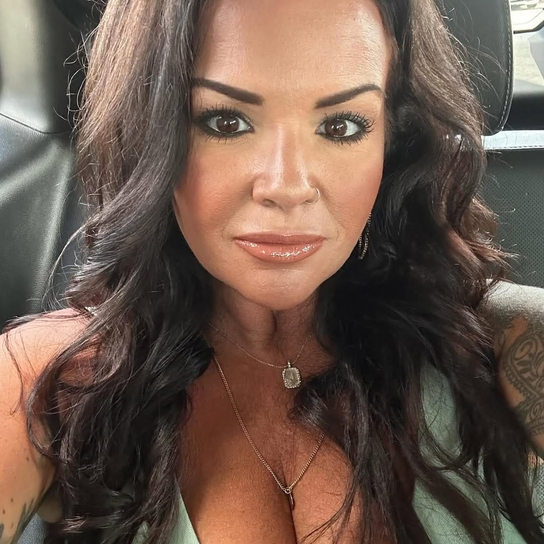Post 3 by HydraFacial, BOTOX, Microneedling, Wax, Spraytan on Instagram (image)