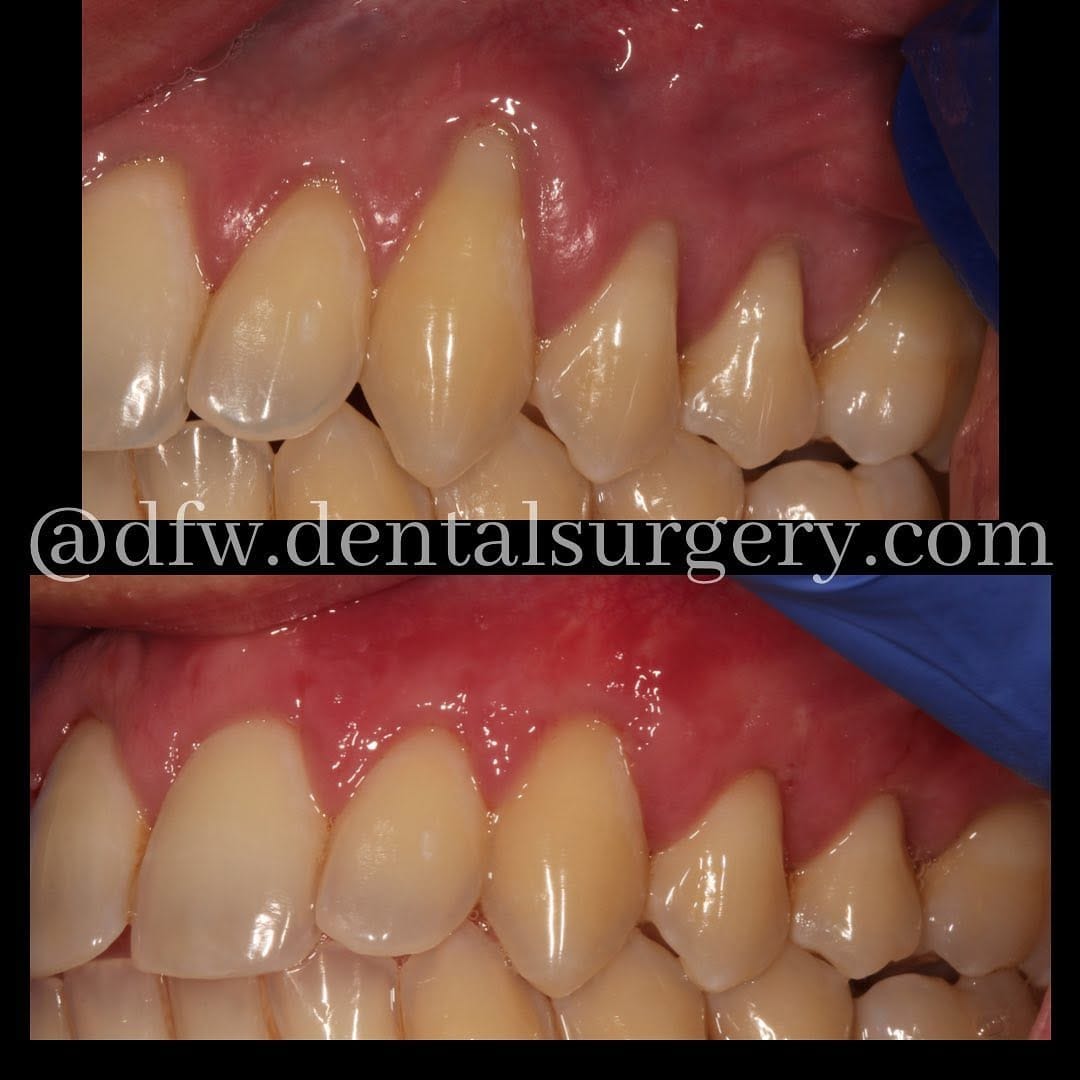 Post 8 by Naveen Karim DDS, MS on Instagram (image)