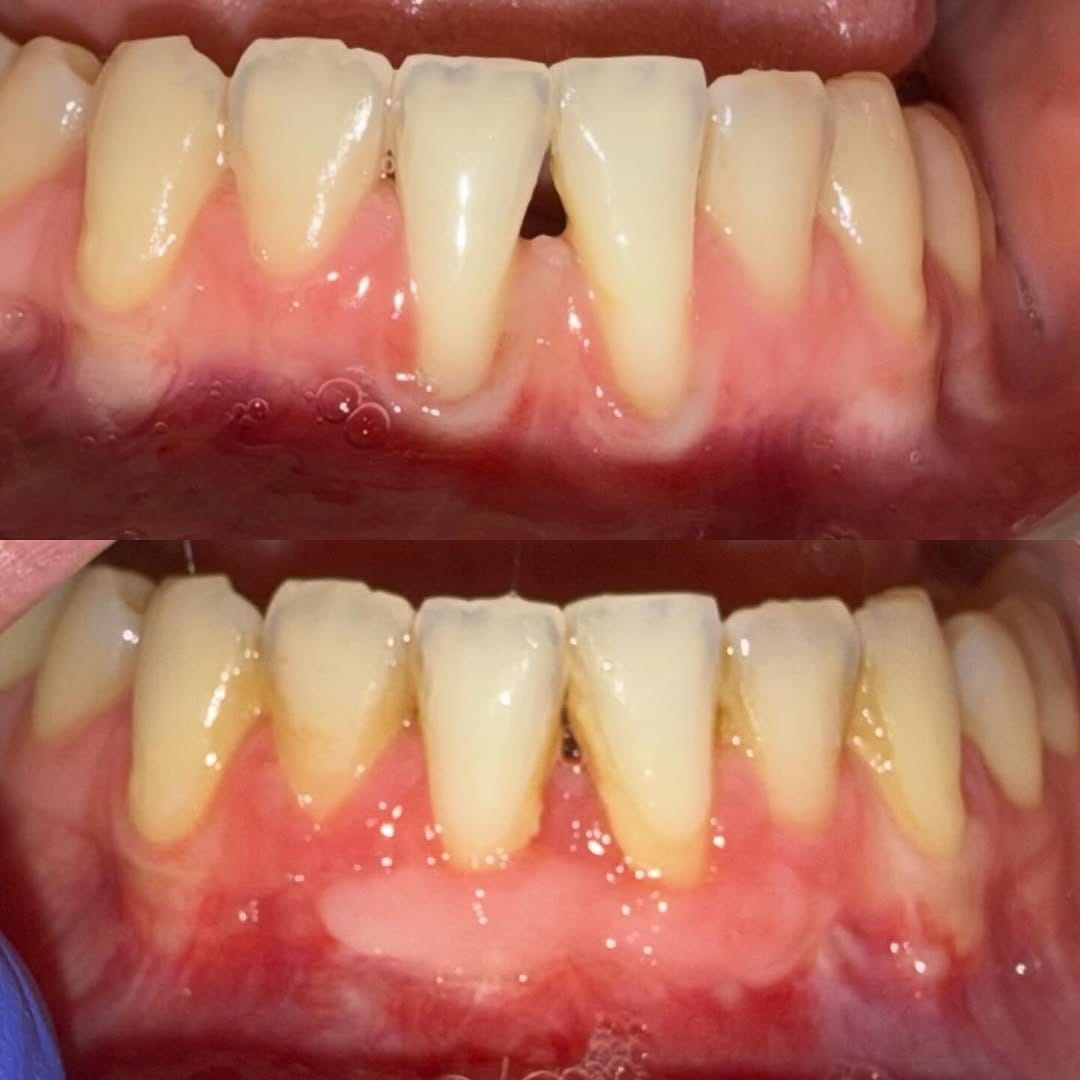 Post 4 by Naveen Karim DDS, MS on Instagram (image)