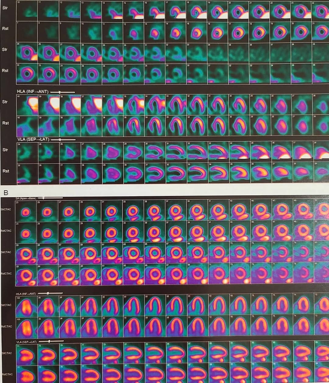 Post 6 by Nuclear Medicine Associates on Instagram (image)