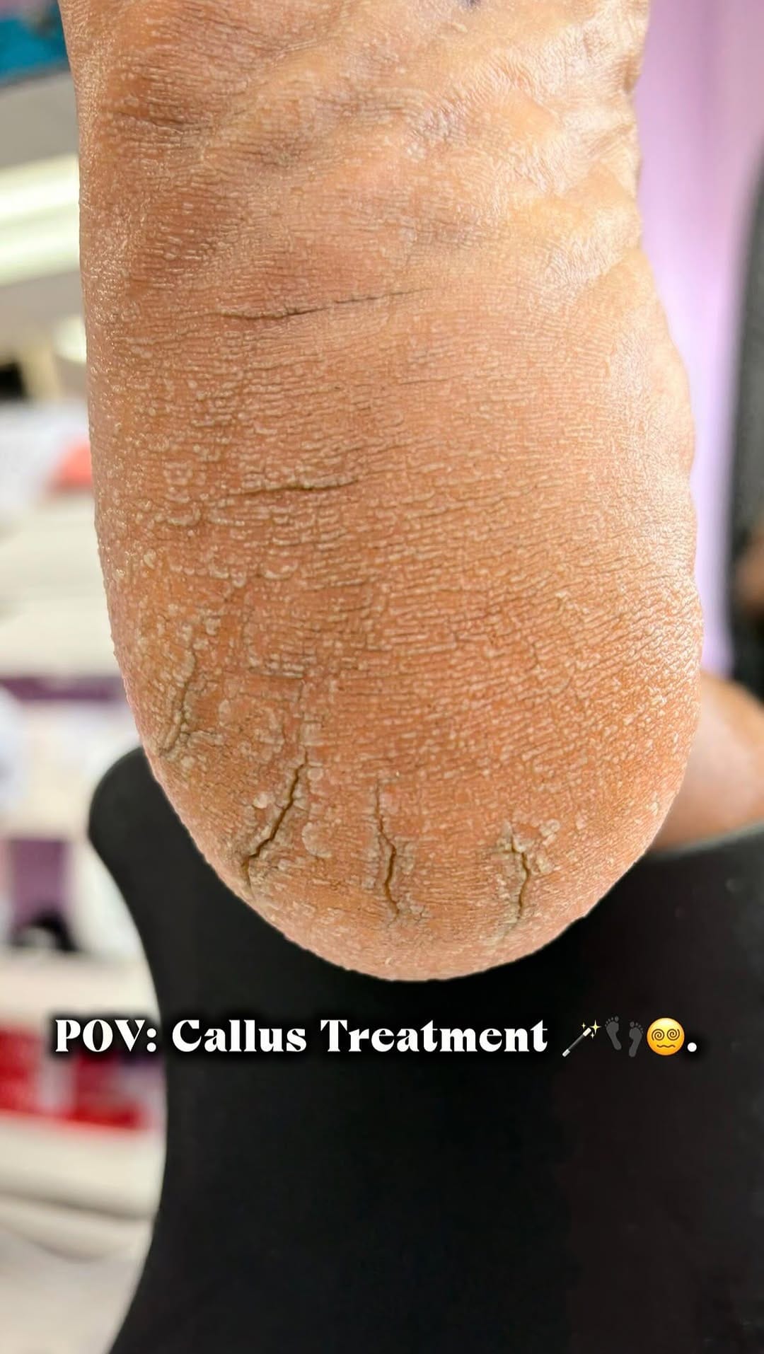 Post 4 by Thee REAL Foot Lady 👣🫧🫶🏾 on Instagram (video)