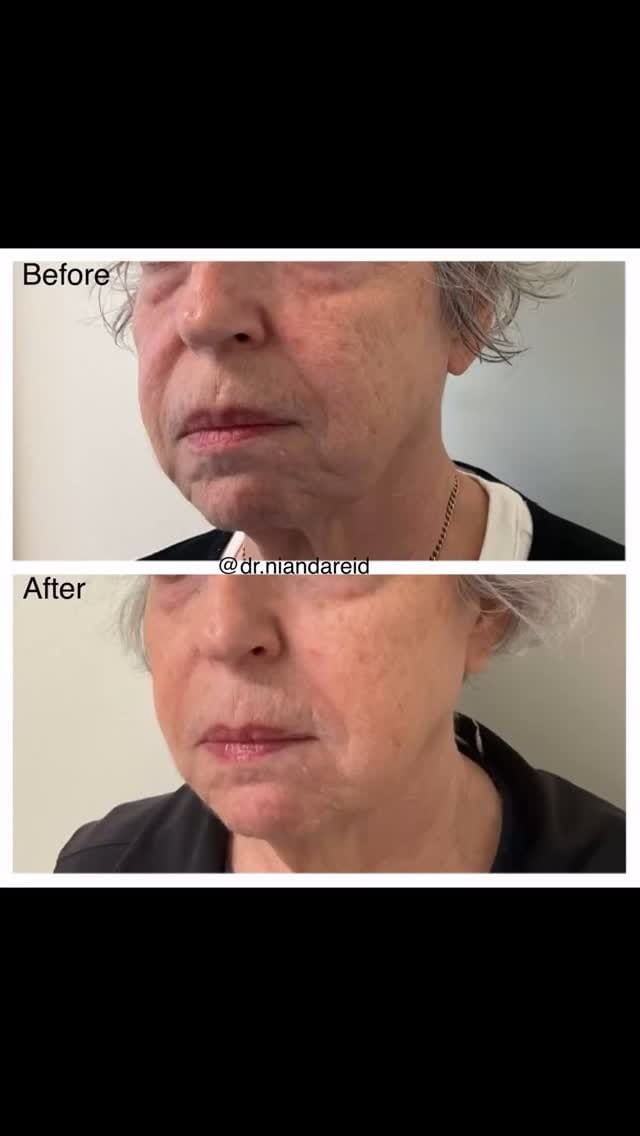 Post 6 by Nianda Reid, MD, MBA, FAAD on Instagram (video)