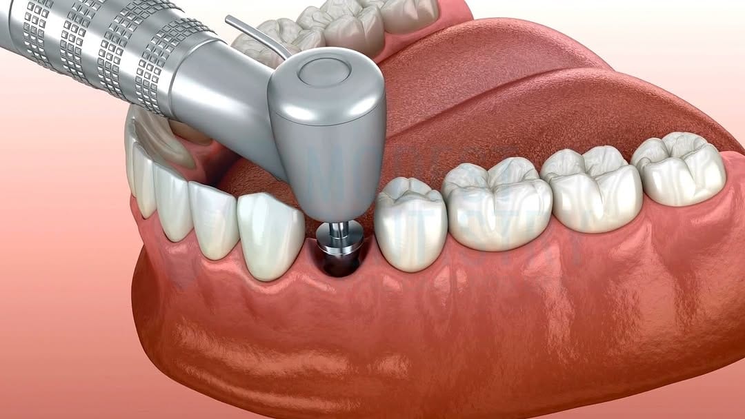 Post 6 by Dental Care For Life on Instagram (video)