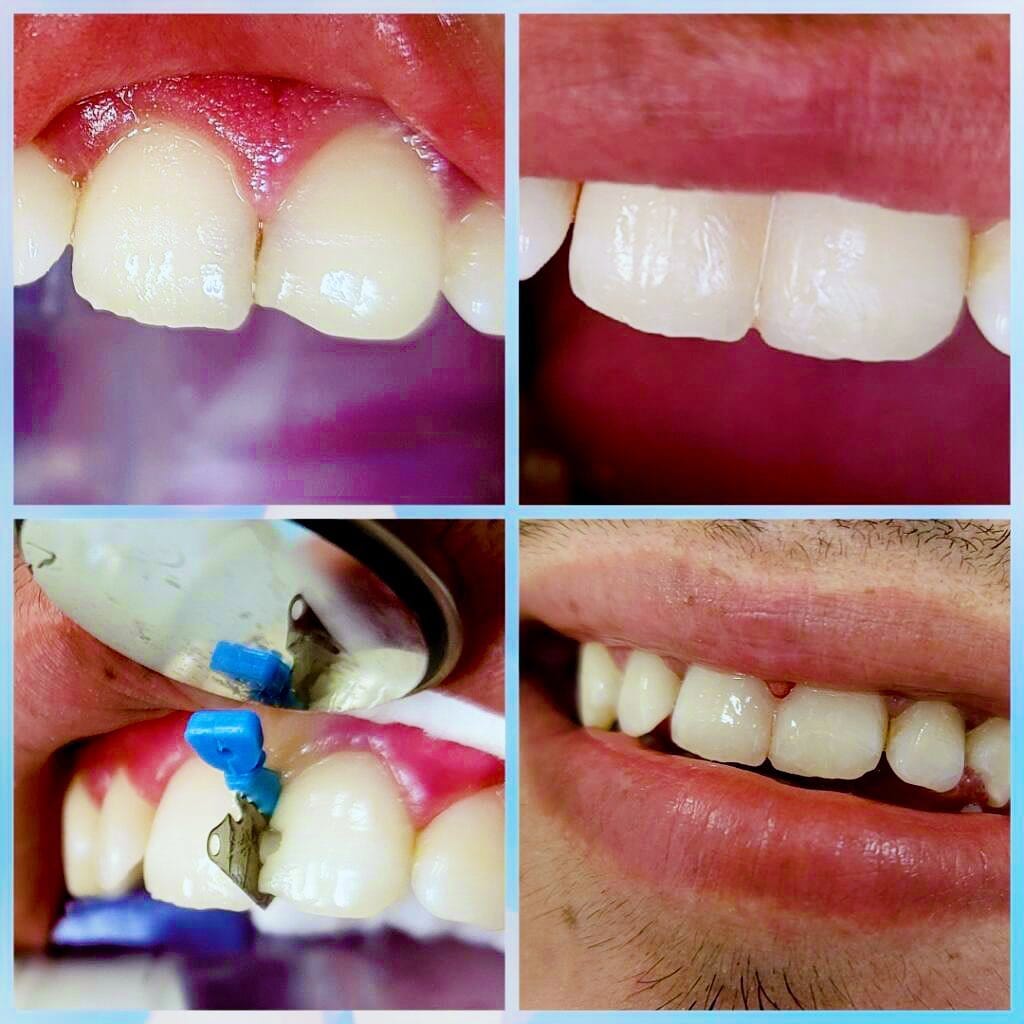 Post 4 by Dental Care For Life on Instagram (image)