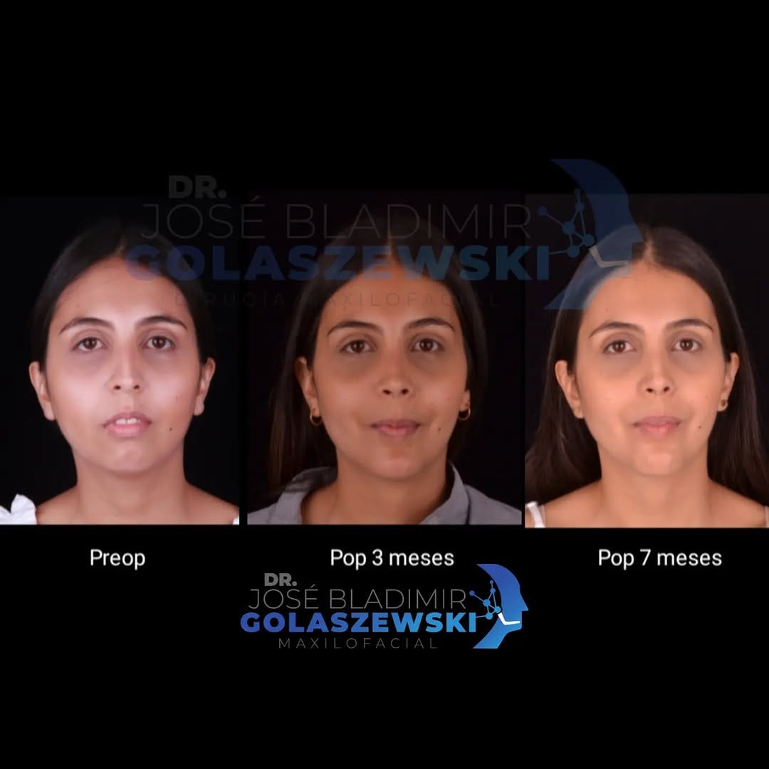 Post 9 by Dr. Jose Bladimir Golaszewski on Instagram (carousel)