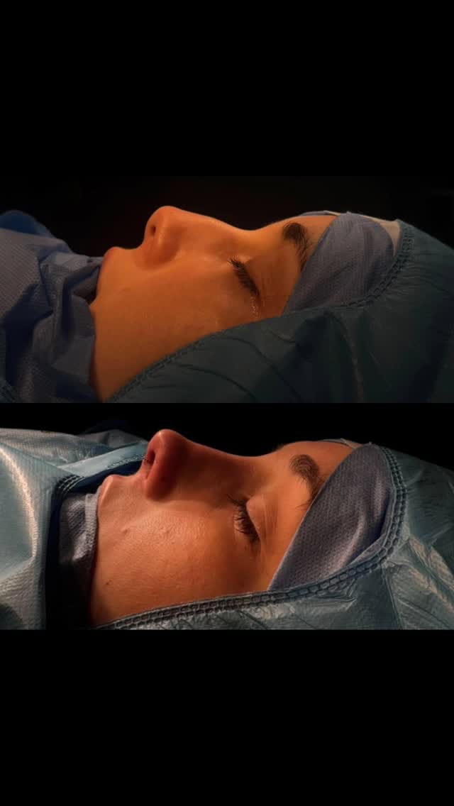 Post 5 by Dr. Jose Bladimir Golaszewski on Instagram (video)