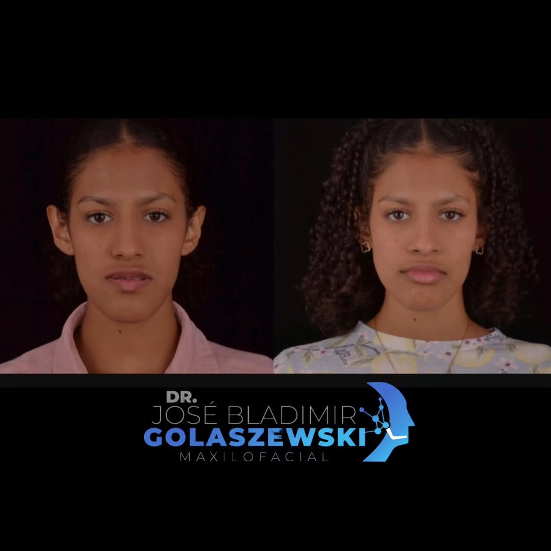 Post 2 by Dr. Jose Bladimir Golaszewski on Instagram (carousel)