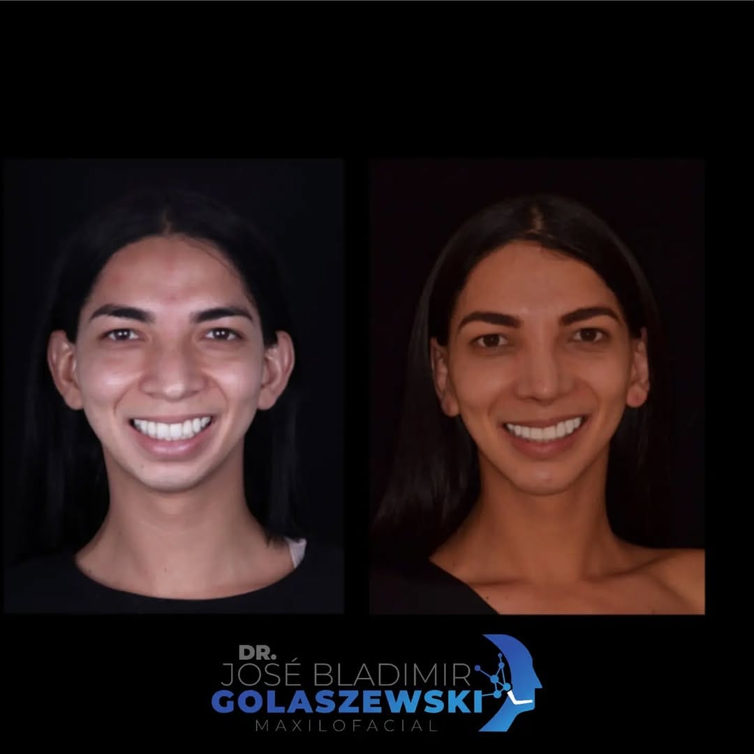 Post 10 by Dr. Jose Bladimir Golaszewski on Instagram (carousel)