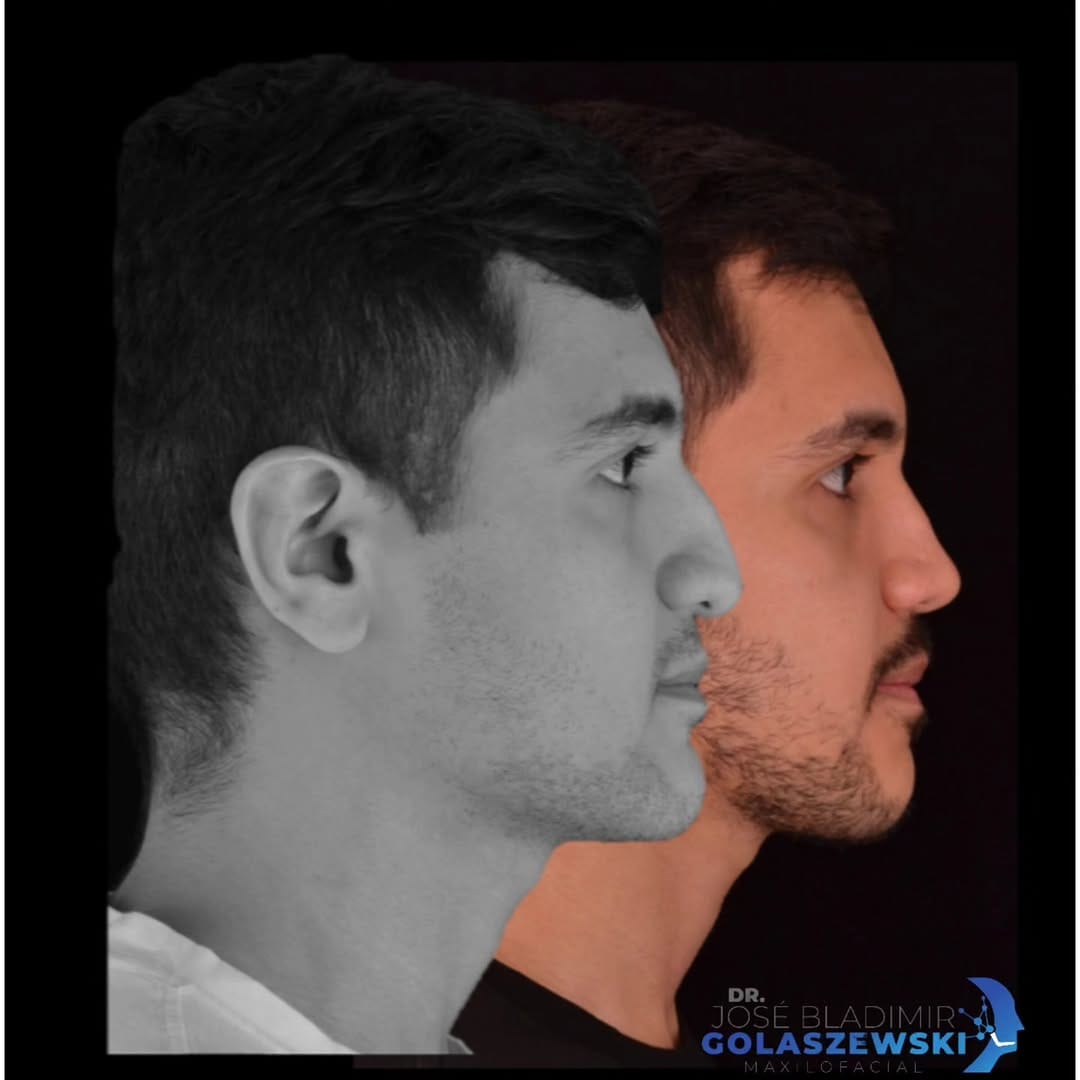Post 8 by Dr. Jose Bladimir Golaszewski on Instagram (carousel)