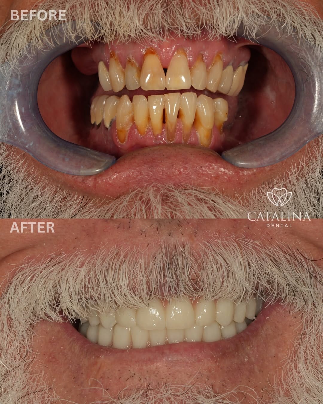 Post 4 by Catalina Dental on Instagram (carousel)