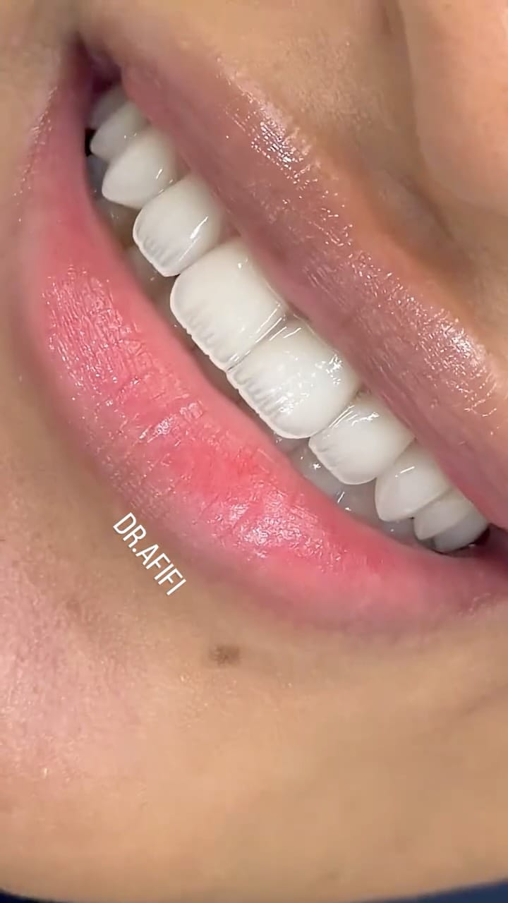 Post 1 by Dr.Mohamed Afifi | Cosmetic Dentist | DUBAI on Instagram (video)