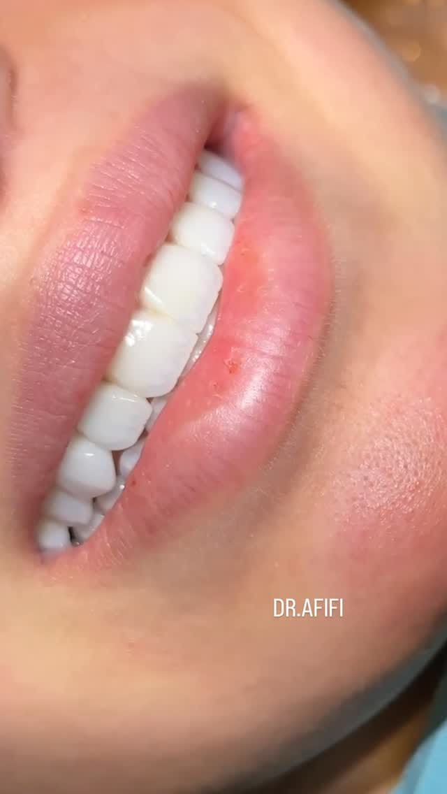Post 7 by Dr.Mohamed Afifi | Cosmetic Dentist | DUBAI on Instagram (video)
