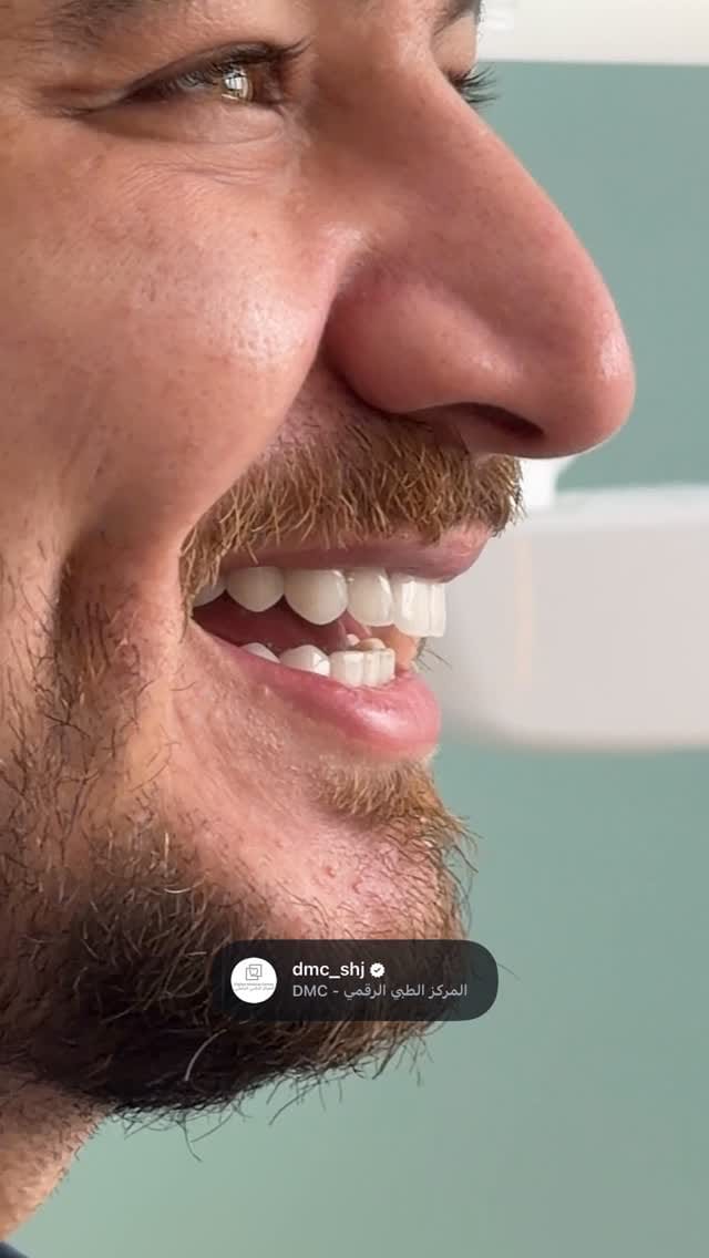 Post 6 by Dr.Mohamed Afifi | Cosmetic Dentist | DUBAI on Instagram (video)