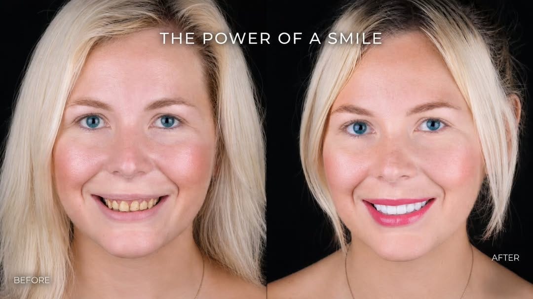 Post 2 by Dr.Mohamed Afifi | Cosmetic Dentist | DUBAI on Instagram (image)