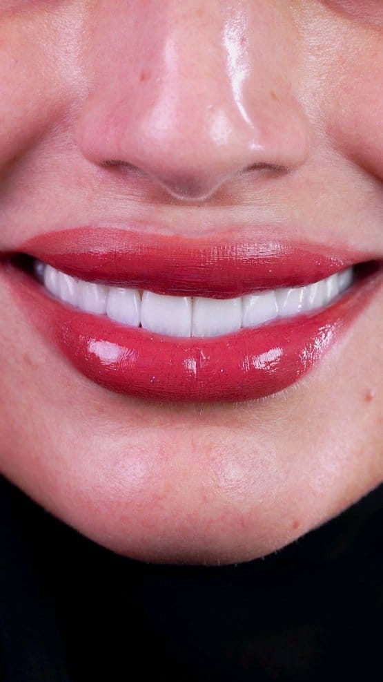 Post 8 by Dr.Mohamed Afifi | Cosmetic Dentist | DUBAI on Instagram (video)