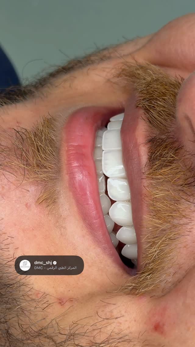 Post 3 by Dr.Mohamed Afifi | Cosmetic Dentist | DUBAI on Instagram (video)